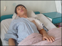 دجګړې ټپيان