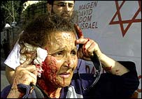 मध्य पूर्व में एक घायल महिला