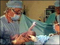 Народження дитини 