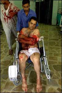 Ferido em ataque com carro-bomba chega a hospital de Bagdá