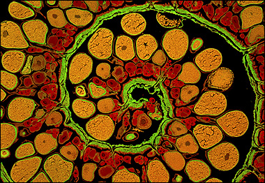 James Hayden, Instituto Wilstar, Pensilvânia, Estados Unido (Foto: Cortesia do Concurso Nikon Small World)