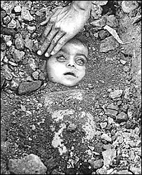 गैस त्रासदी का शिकार मासूम