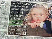 Criança com síndrome de Down. Foto Cortesia: Down's Syndrome Association.