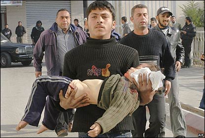 Homem carrega criança ferida na Faixa de Gaza