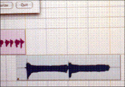 condom_waveform.png
