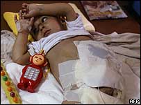 Criança sendo tratada em hospital de Falluja