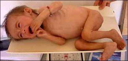 خوار ځواکی ماشوم