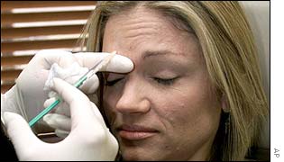 Botulotoxin vpíchnutý do vrásky dočasně způsobí obrnu okolních svalů 