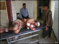 Trabalhador iraquiano ferido