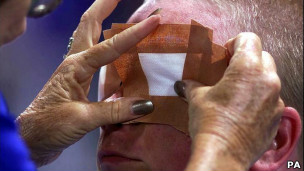 Гравцеві одягають пов'язку перед грою у голбол