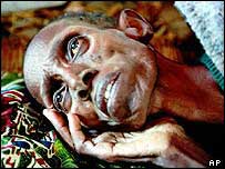 Açlık çeken bir Afrikalı