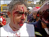 Manifestantes ficaram feridos durante os choques