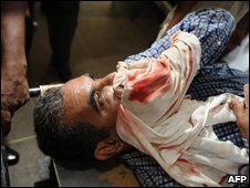 Upali Tennakoon after the assault