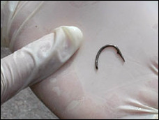 The hook removed from Florence