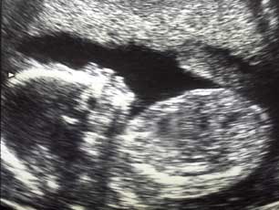 Ultrasound scan image