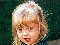 Criança com síndrome de Down 