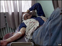 Афганець, який отримав поранення внаслідок вибуху