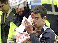 Një prej të lënduarve të sulmeve me eksplozivë në Madrid