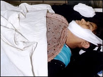 يوه ژوبل شوې ماشومه په روغتون کې