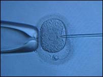 Técnica polêmica pode permitir que mulheres inférteis engravidem