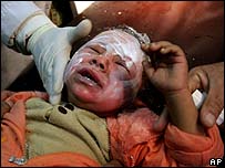 Saldırıda yaralanan bir çocuk