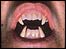 A vampire's teeth
