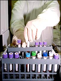 Antidopingové testy 