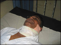 Anurasiri Hettige in the hospital