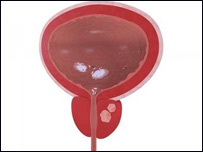 غدد پروستاد