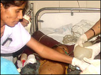 मालेगाँव धमाकों में ज़ख़्मी हुए लोग