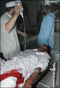 घायल (फ़ाइल फ़ोटो)