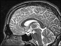 Imagem de ressonância magnética