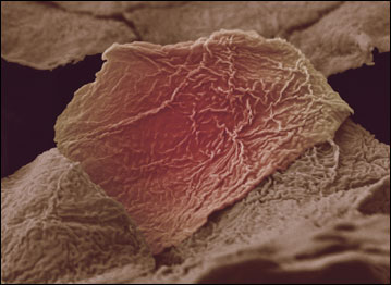 Célula queimada (Foto: Anne Weston/Wellcome Image Awards 2009)