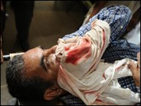 श्रीलंका में पत्रकार पर हमला