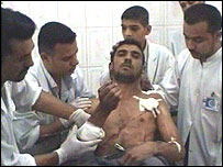 Ferido em hospital de Baquba