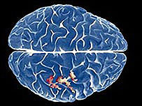 दिमाग़ (फ़ाइल फ़ोटो)