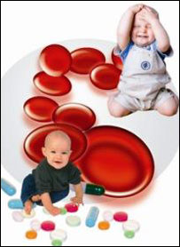 کم خونی اطفال