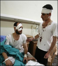 زخمی های انفجار دمشق