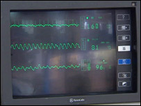 heart monitor