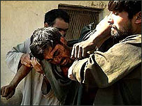 يک کارگر مصدوم معدن ذغال سنگ کرکر در افغانستان