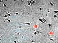 جرثومے مائئکرسکوپ کے نیچے