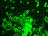 bactéria F.tularensis