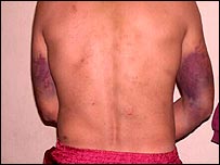 غیر ملکی پر تشدد 