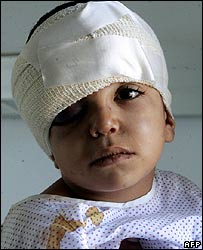 Nạn nhân một cuộc tấn công