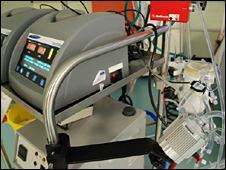 ECMO machine