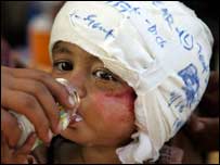 Depremde yaralanan bir çocuk