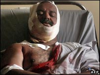 Saldırılarda yaralanan bir Iraklı