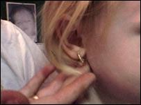 Child with pierced ear