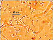 Bakterie mléčného kvasení rodu Lactobacillus brevis