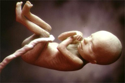 Image: foetus model